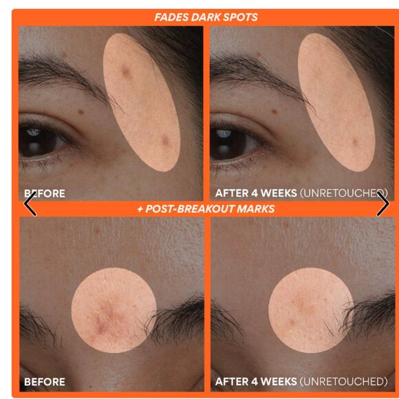 NWT Innisfree Green Tea Enzyme Vitamin C Brightening Serum - Picture 2 of 15